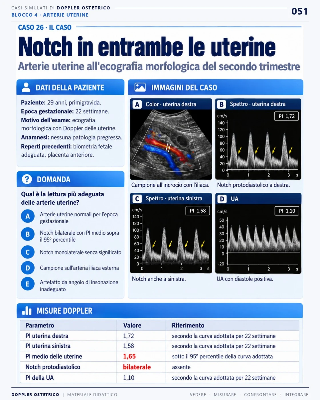 Pagina 51: Caso 26: notch in entrambe le uterine. Estratto dal PDF di Doppler Ostetrico e Fetale in italiano.